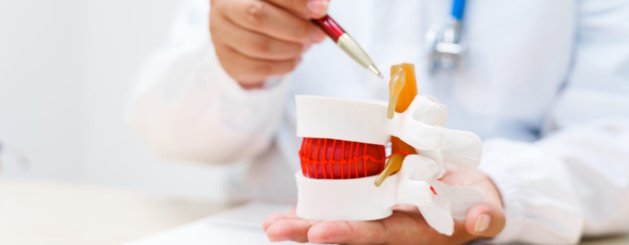 A doctor uses an anatomical lumbar disc herniation model to explain spinal health